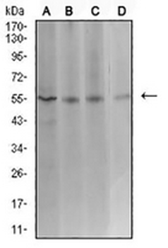 ASF1B Mouse Monoclonal Antibody