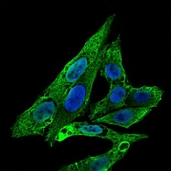 RhoGDI alpha Mouse Monoclonal Antibody