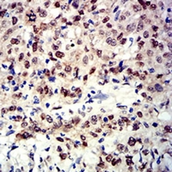 APE1 Mouse Monoclonal Antibody