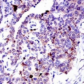 Annexin A1 Mouse Monoclonal Antibody
