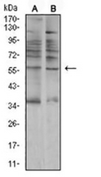 AMY1A Mouse Monoclonal Antibody