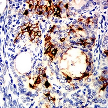 ALPPL2 Mouse Monoclonal Antibody