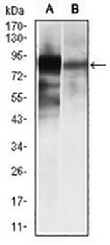 ALPL Mouse Monoclonal Antibody