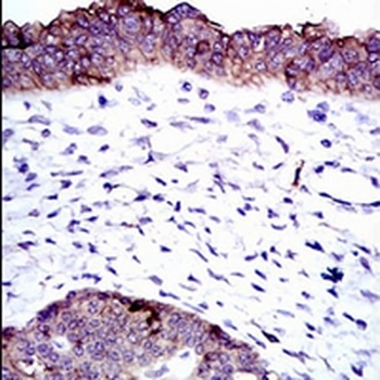 ALPL Mouse Monoclonal Antibody