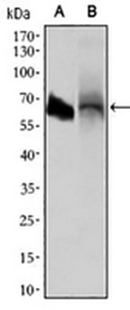 ALPI Mouse Monoclonal Antibody