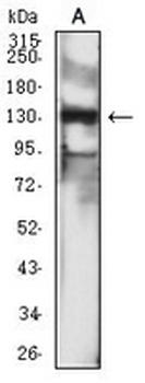 CD246 Mouse Monoclonal Antibody