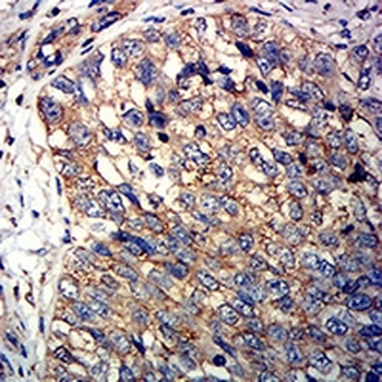 CD246 Mouse Monoclonal Antibody