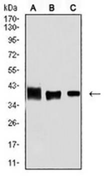 ALDOA Mouse Monoclonal Antibody