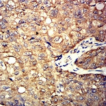 ALDOA Mouse Monoclonal Antibody