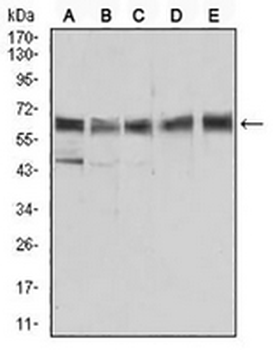ALDH6A1 Mouse Monoclonal Antibody