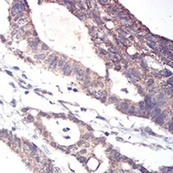 ALDH6A1 Mouse Monoclonal Antibody