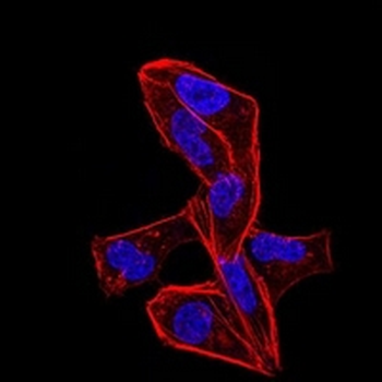 ALDH6A1 Mouse Monoclonal Antibody