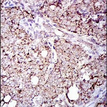 ALDH2 Mouse Monoclonal Antibody