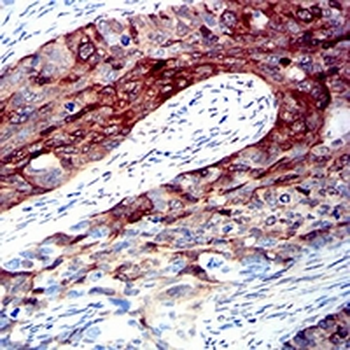 ALDH1A1 Mouse Monoclonal Antibody