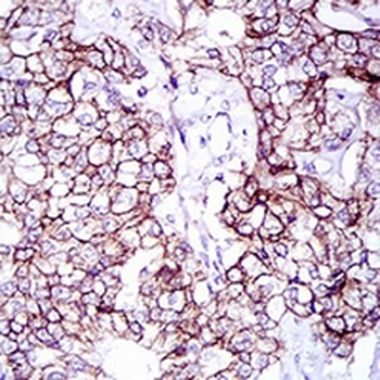 CD166 Mouse Monoclonal Antibody