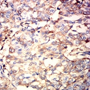 ALB Mouse Monoclonal Antibody