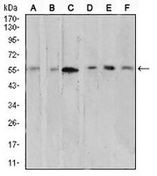 AKT Mouse Monoclonal Antibody