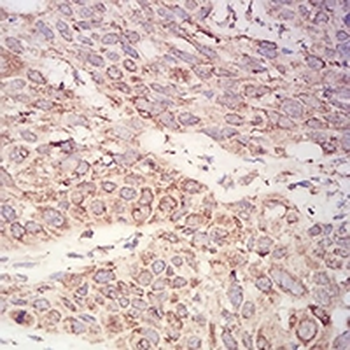 AKT Mouse Monoclonal Antibody