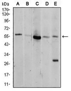 AKT Mouse Monoclonal Antibody