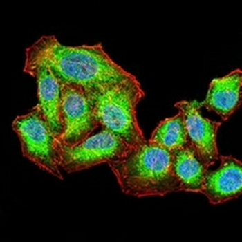 AKT Mouse Monoclonal Antibody