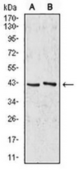 AIM2 Mouse Monoclonal Antibody