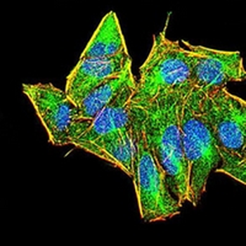 AIM2 Mouse Monoclonal Antibody