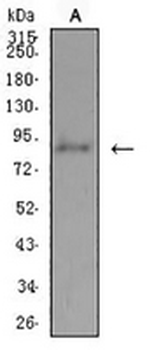 ADAMTS1 Mouse Monoclonal Antibody