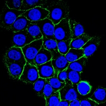 CD156b Mouse Monoclonal Antibody