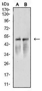ARP3 Mouse Monoclonal Antibody