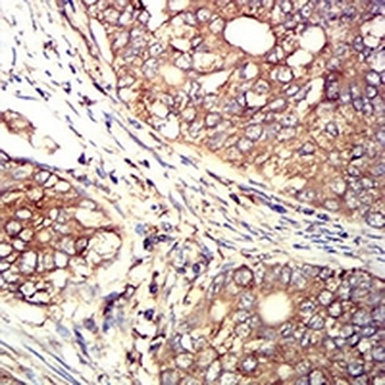 ARP3 Mouse Monoclonal Antibody
