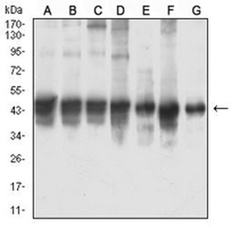 Smooth Muscle Actin Mouse Monoclonal Antibody