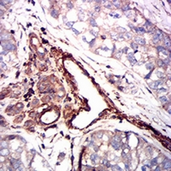 Smooth Muscle Actin Mouse Monoclonal Antibody
