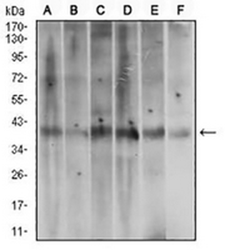 ACP5 Mouse Monoclonal Antibody