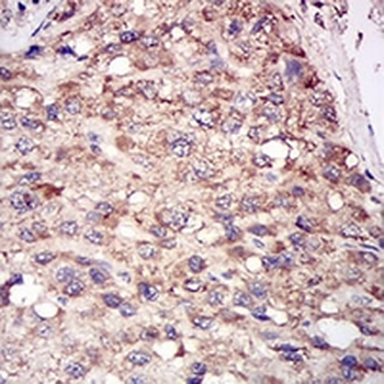 ACP5 Mouse Monoclonal Antibody