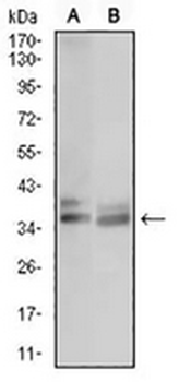 ACP5 Mouse Monoclonal Antibody