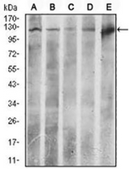ACLY Mouse Monoclonal Antibody