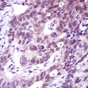 ACLY Mouse Monoclonal Antibody