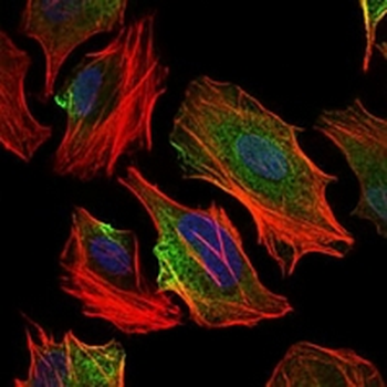 ACLY Mouse Monoclonal Antibody
