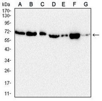 Acetylcholinesterase Mouse Monoclonal Antibody