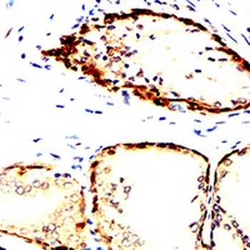Acetylcholinesterase Mouse Monoclonal Antibody