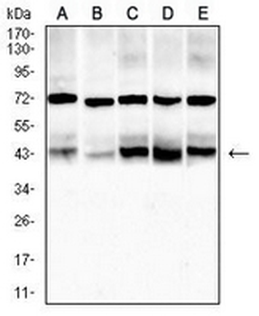 ACADM Mouse Monoclonal Antibody