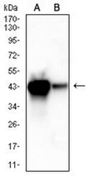 ACAA1 Mouse Monoclonal Antibody