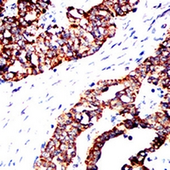 ACAA1 Mouse Monoclonal Antibody