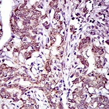 ABCG5 Mouse Monoclonal Antibody
