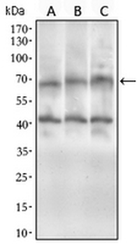 ABCG5 Mouse Monoclonal Antibody