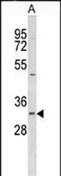 MRP3 Mouse Monoclonal Antibody