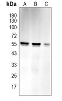 AKT Rabbit Polyclonal Antibody