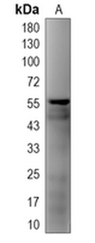 AKT Rabbit Polyclonal Antibody