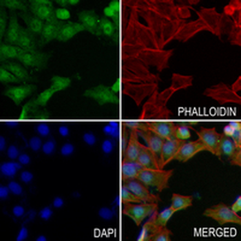 AKT Rabbit Polyclonal Antibody