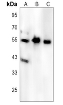 MLKL (Phospho-S125) Rabbit Polyclonal Antibody